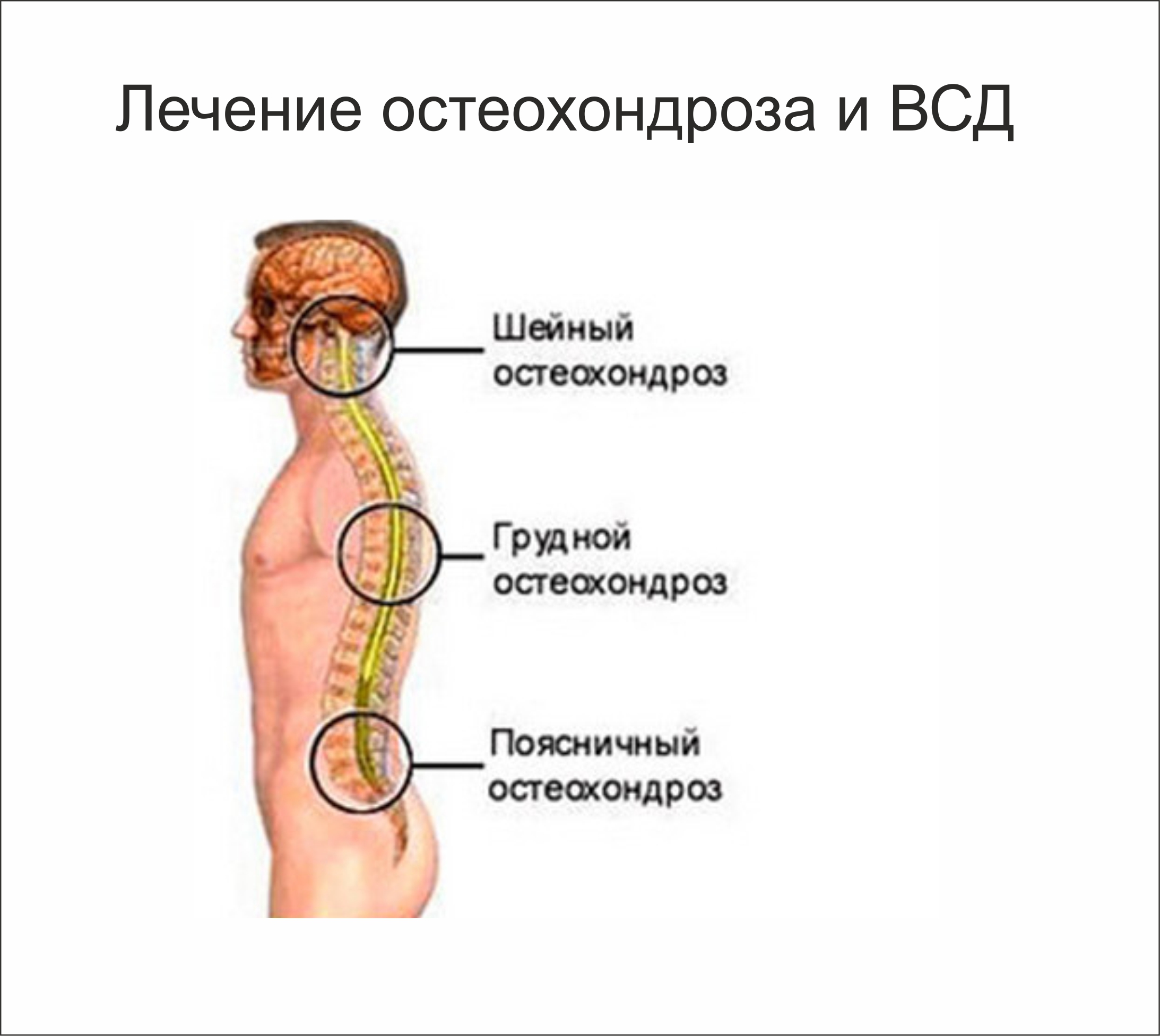 Как лечить грудной 43 Как лечить грудной 83