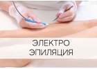 Электроэпиляция Зеленоград